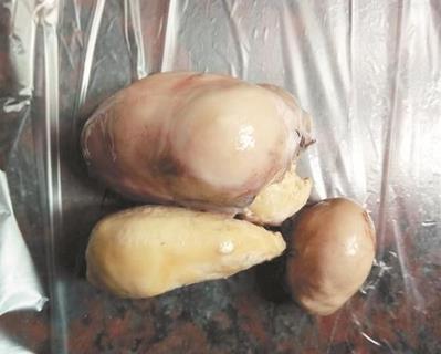 女子殺雞發(fā)現(xiàn)雞寶